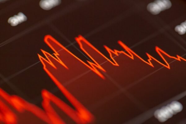 Oil Prices Plunge, Global Markets Surge After Trump Announces Israel-Iran Ceasefire